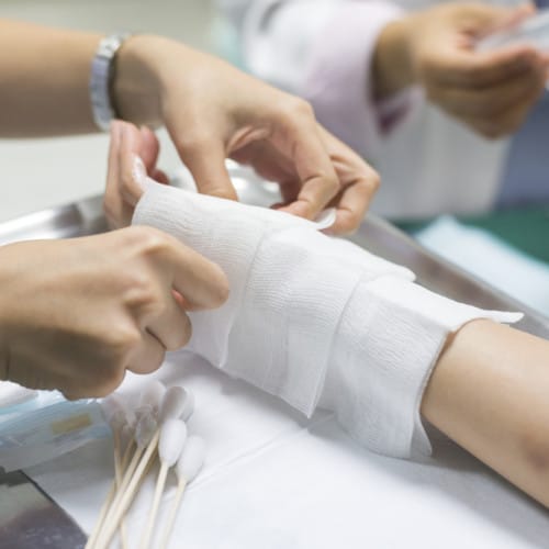 Burn Wounds Treatment in Lahore, Burn Wounds Treatment in Pakistan