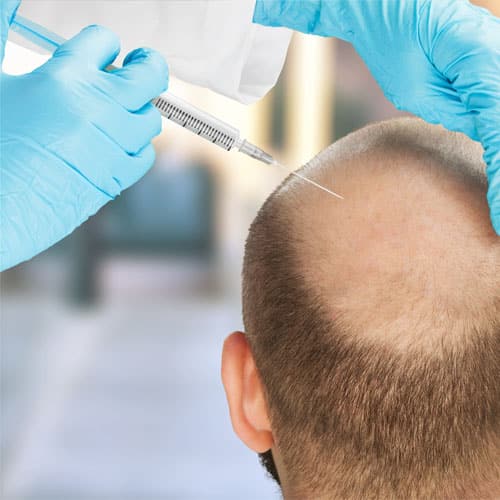 Hair Transplant in lahore , Hair Transplant solution in Pakistan