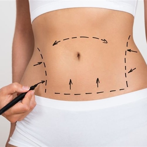 Liposuction treatment in Lahore , Liposuction treatment in Pakistan