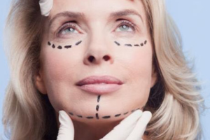 Plastic surgery in Lahore, Plastic surgery Pakistan